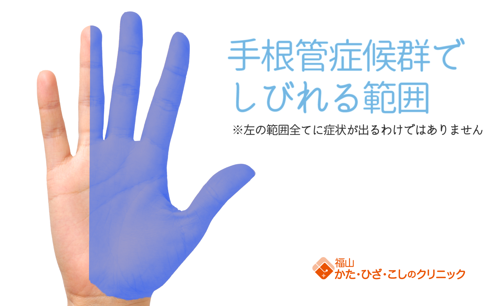 手根管解放の準備