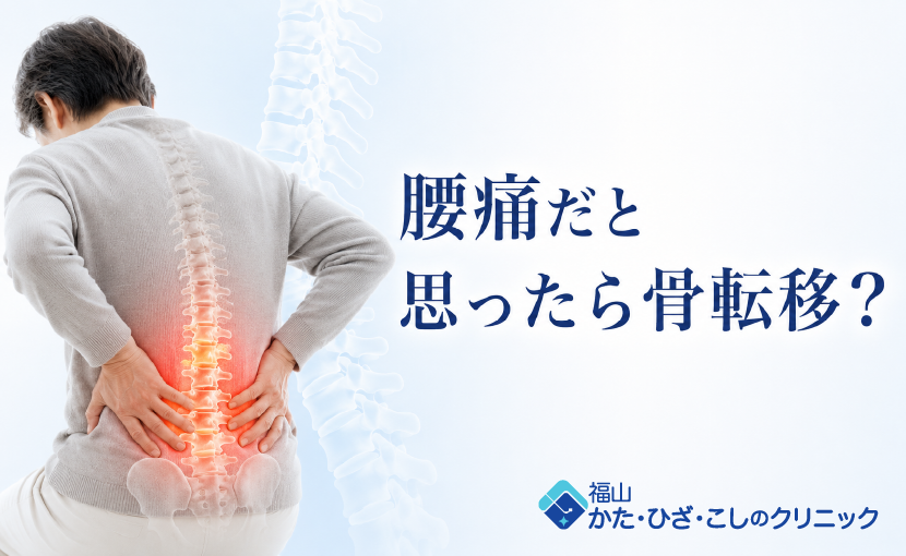 骨転移を疑う腰痛